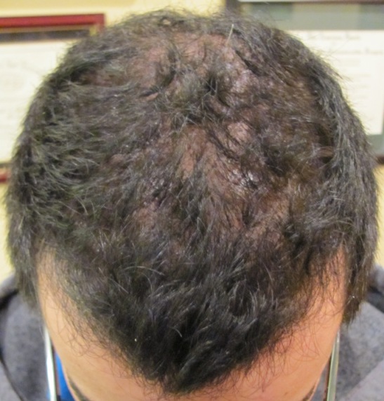 stick_-_place_2.jpg stick_-_place_2.jpg